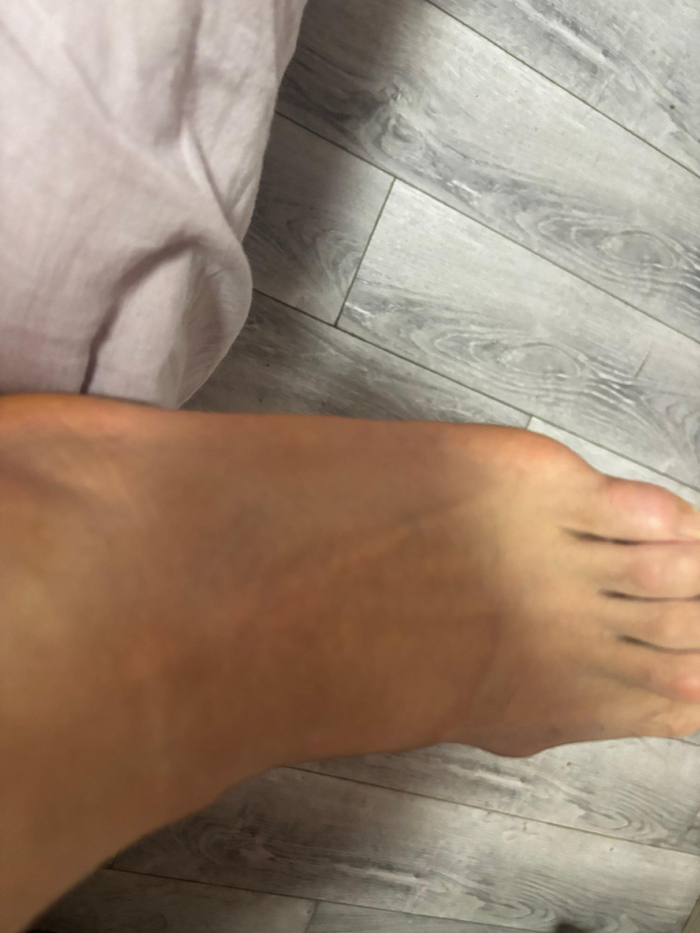 球员比赛中意外崴脚 难以继续参赛